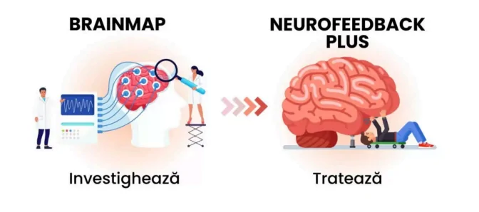 centru BrainMap