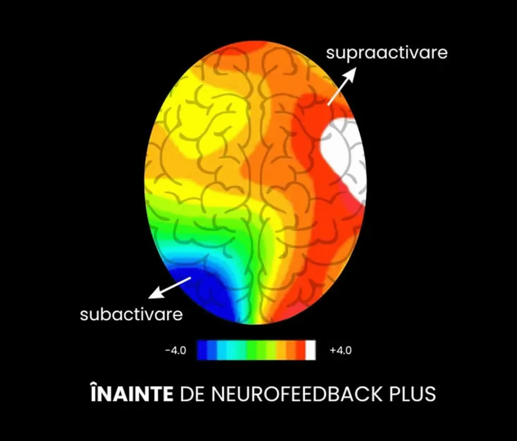 Înainte